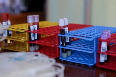 Przy Westerplatte stanie mobilny punkt krwiodawstwa i zbierze chętnych przed południem